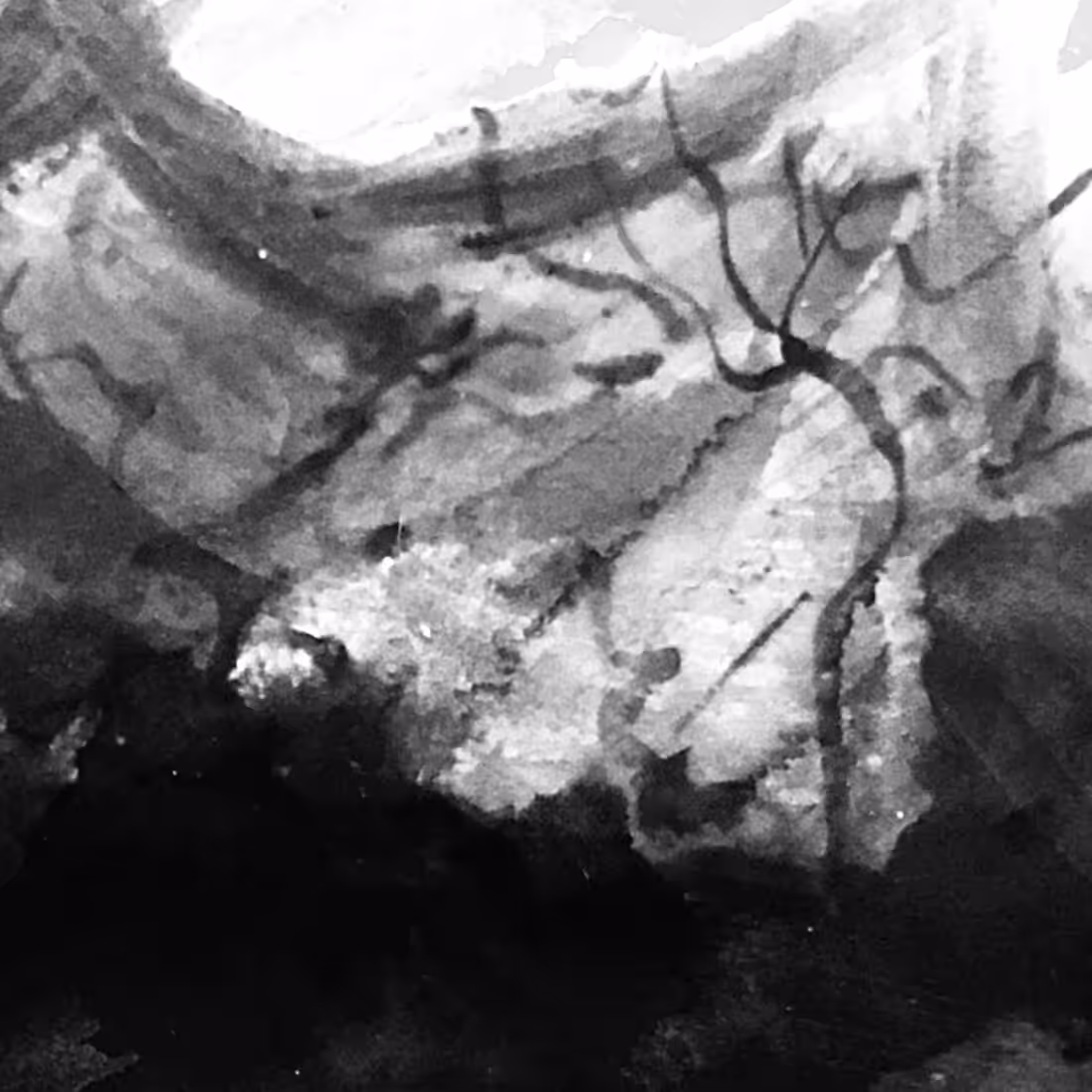 Unknown Shadows