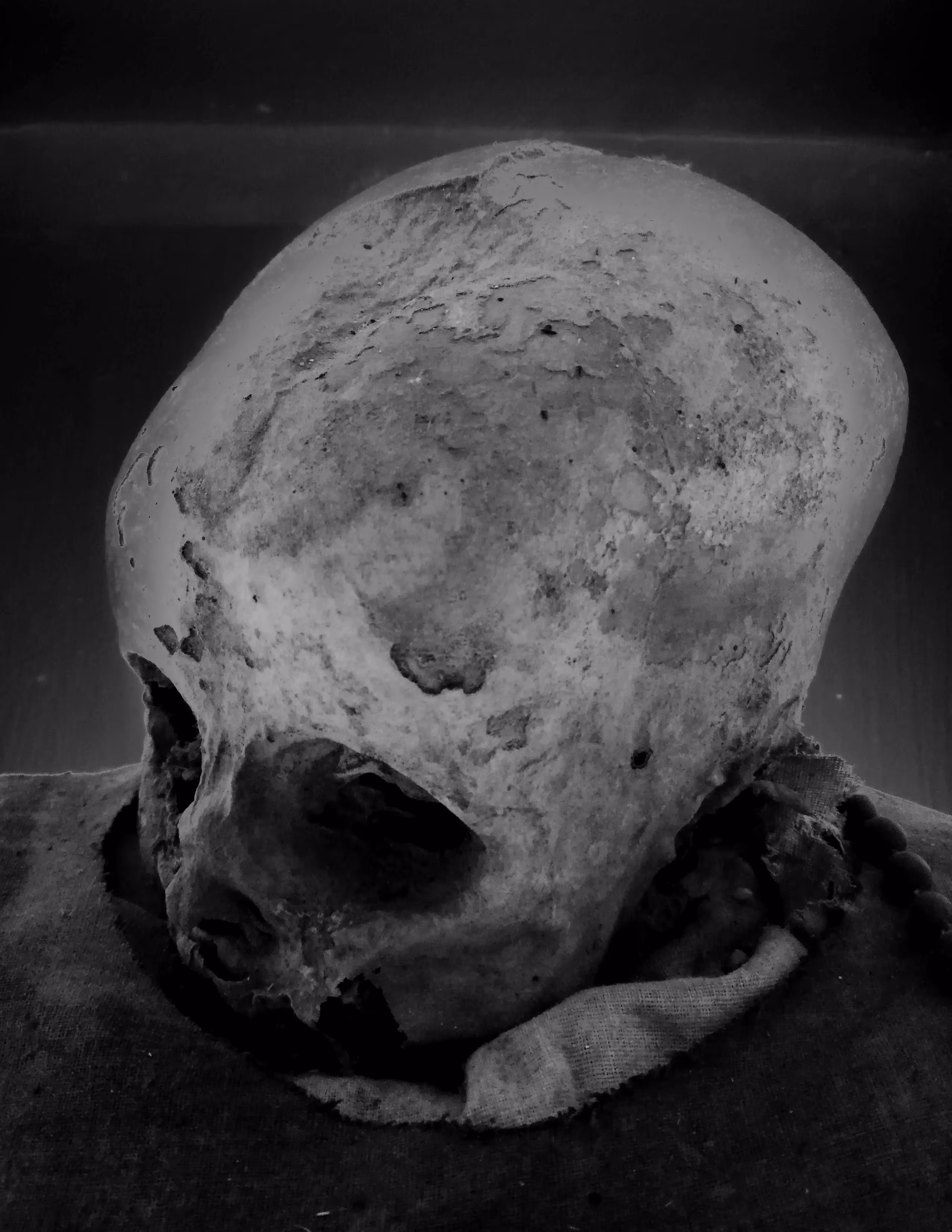 crib death | mort au berceau | muerte de cuna