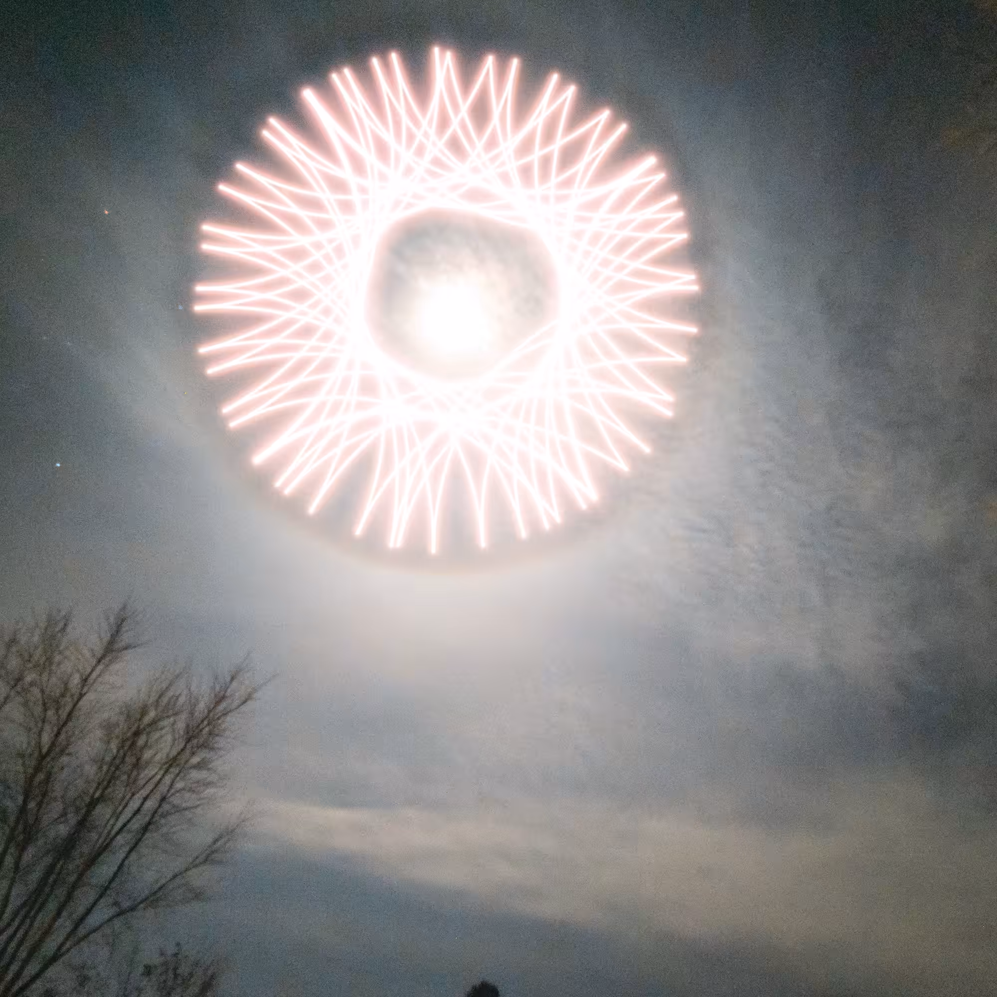 cornea