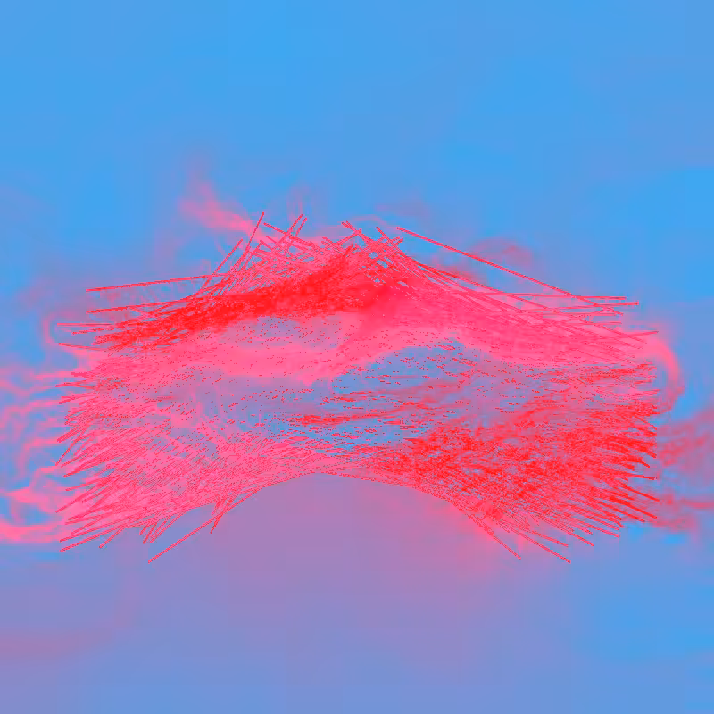 xxf #18