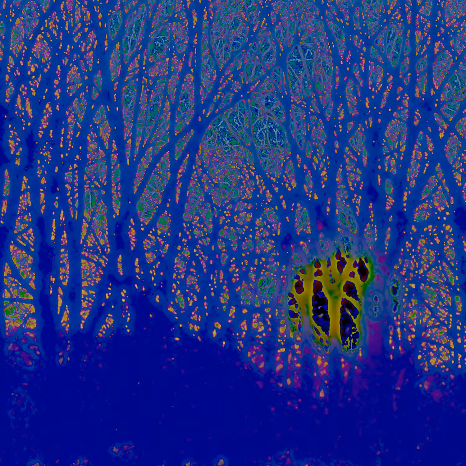 Sunset Thru Trees