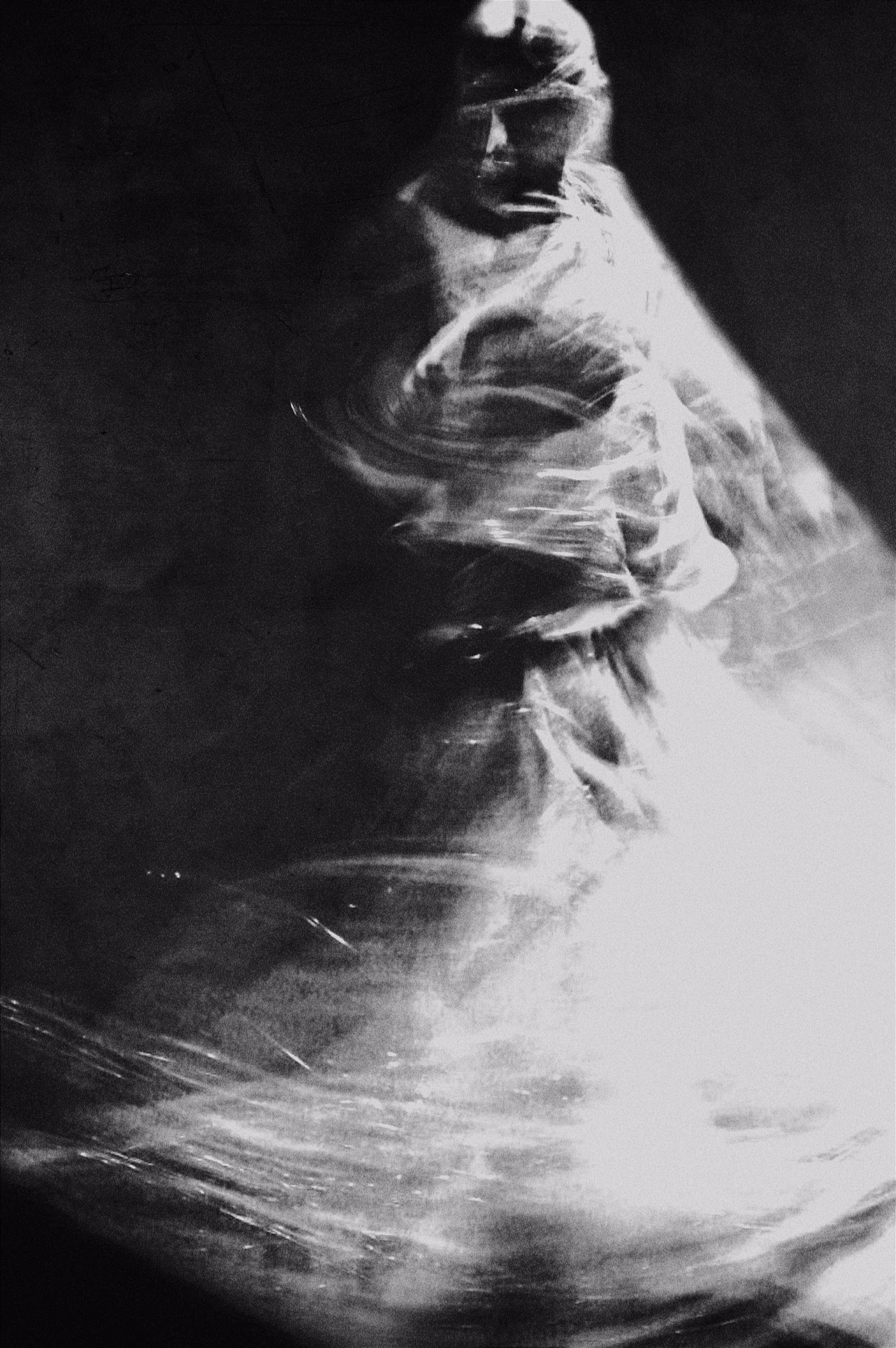 ElizaBedsh