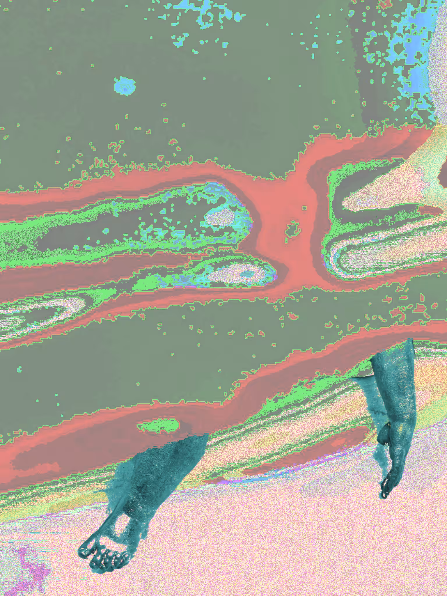 distal