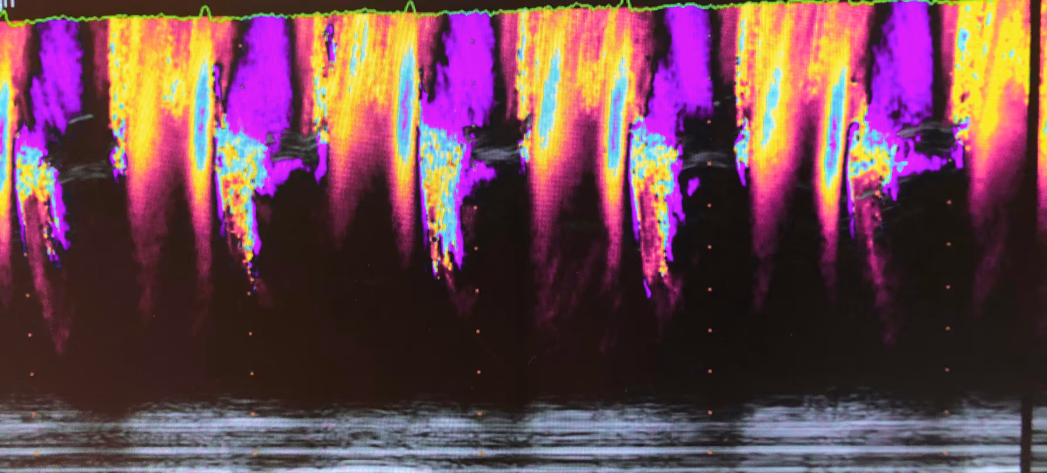 Blood Flow On Fire