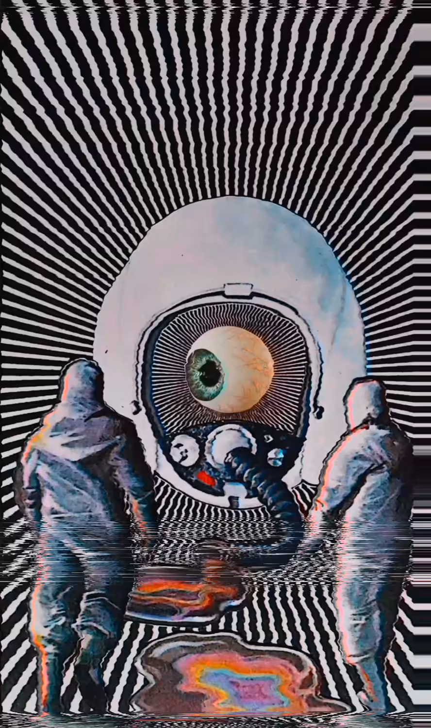 visual migraine