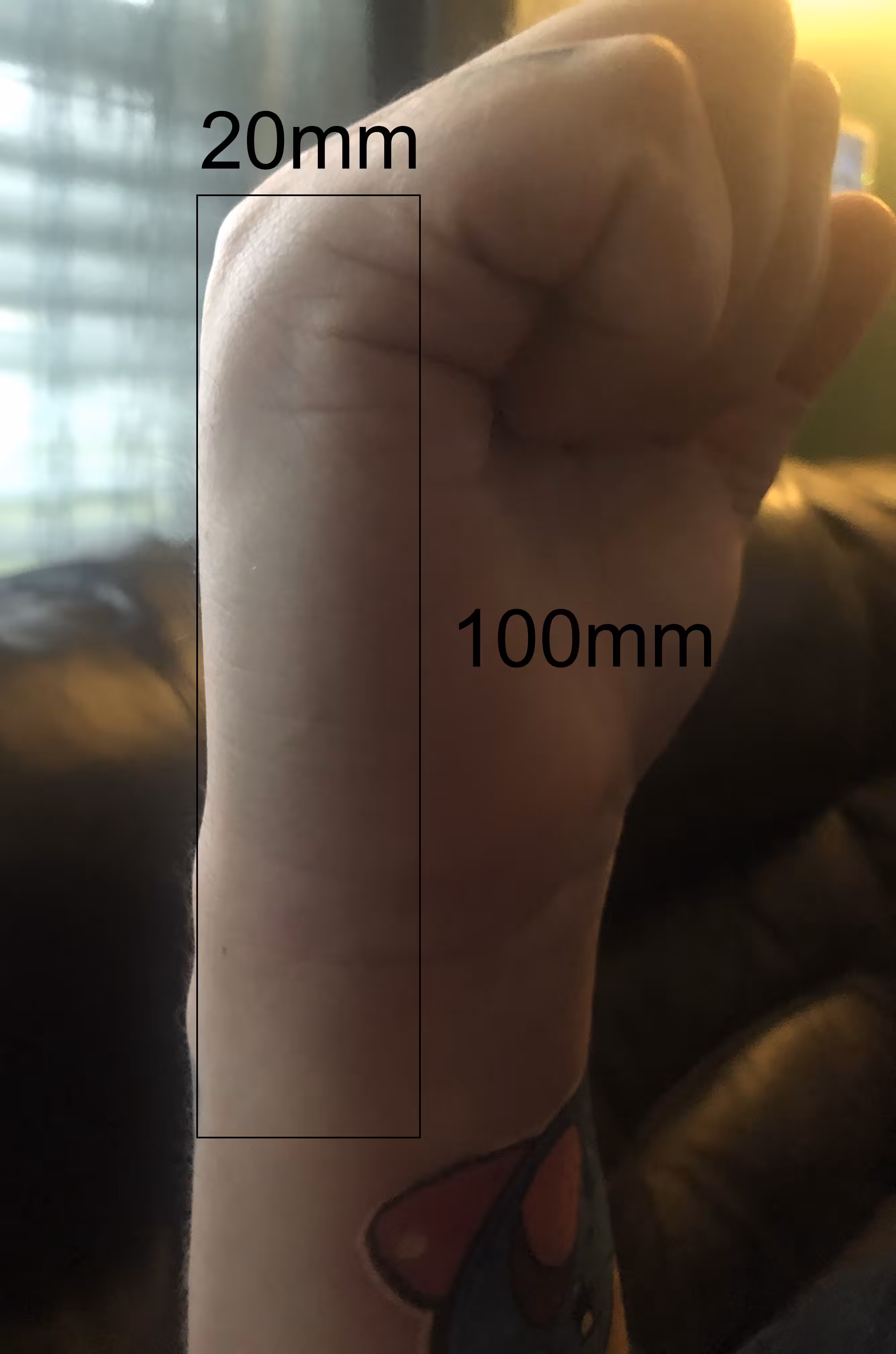 Lot #6 [20mm x 100mm - Right Hand/Wrist Bottom]