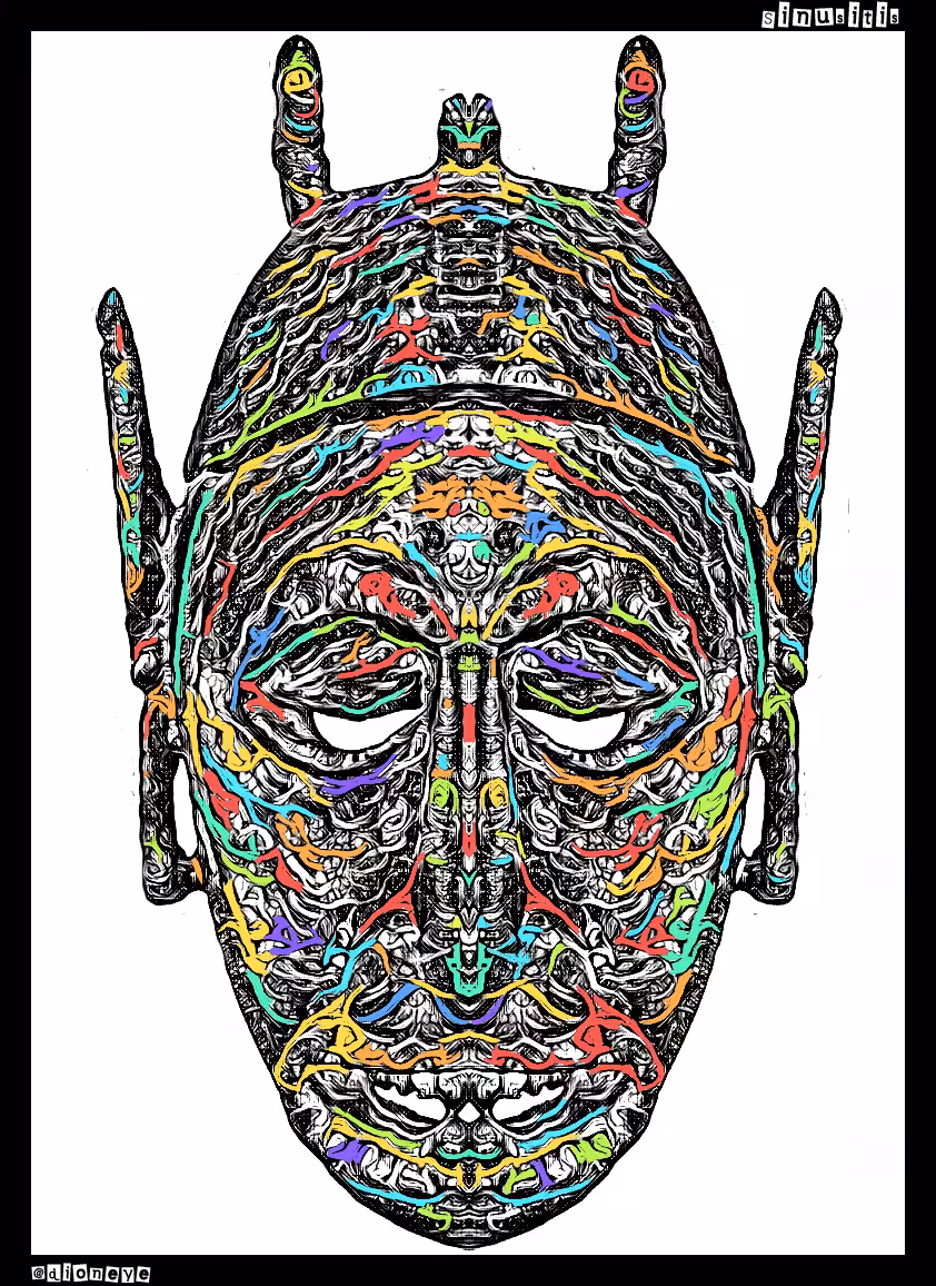 Sinusitis