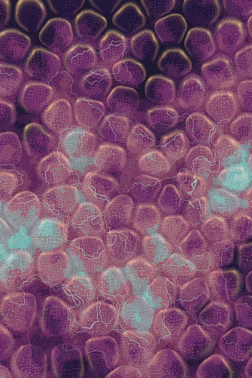 Vitreous #5