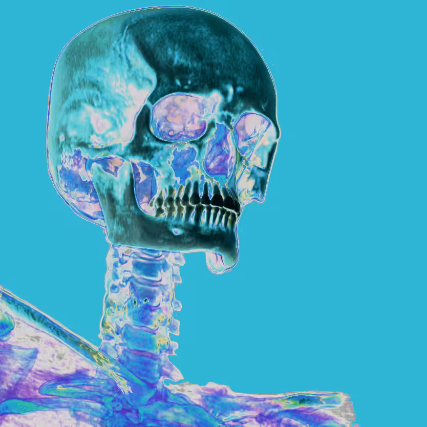 Vanit'X Subject #13