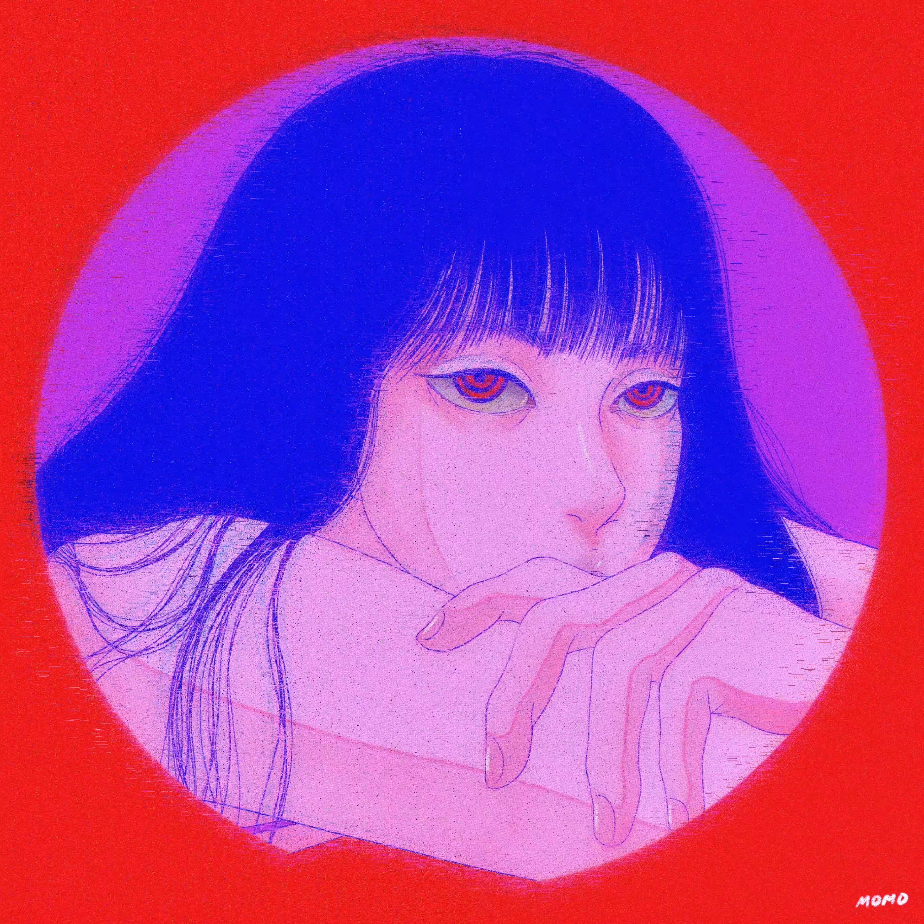 Narcolepsy
