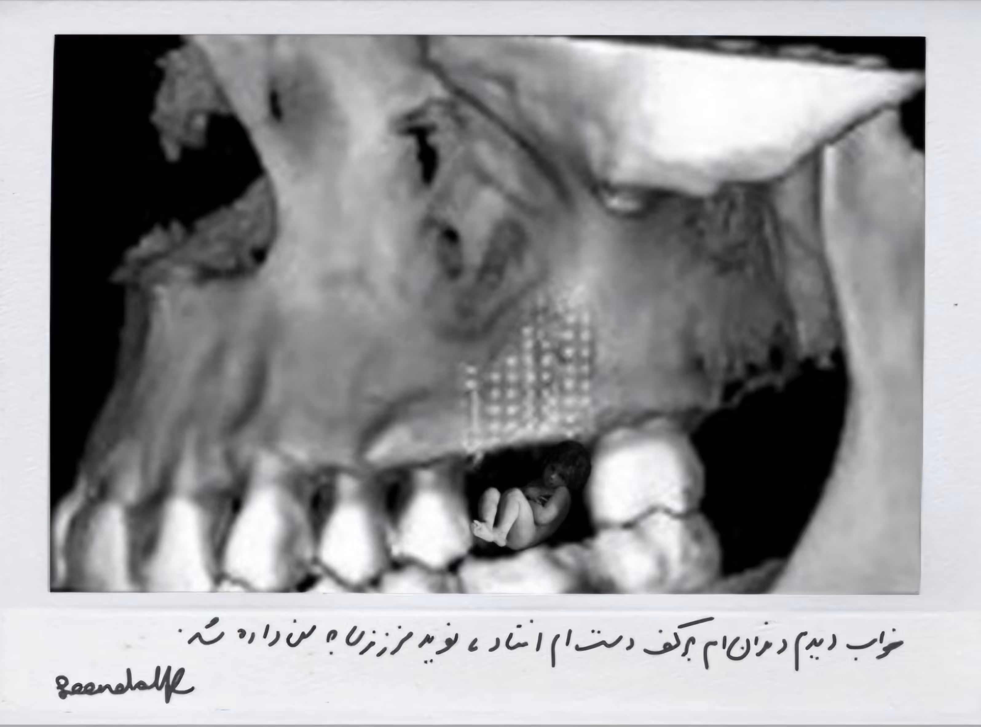 A child was hiding in my tooth 