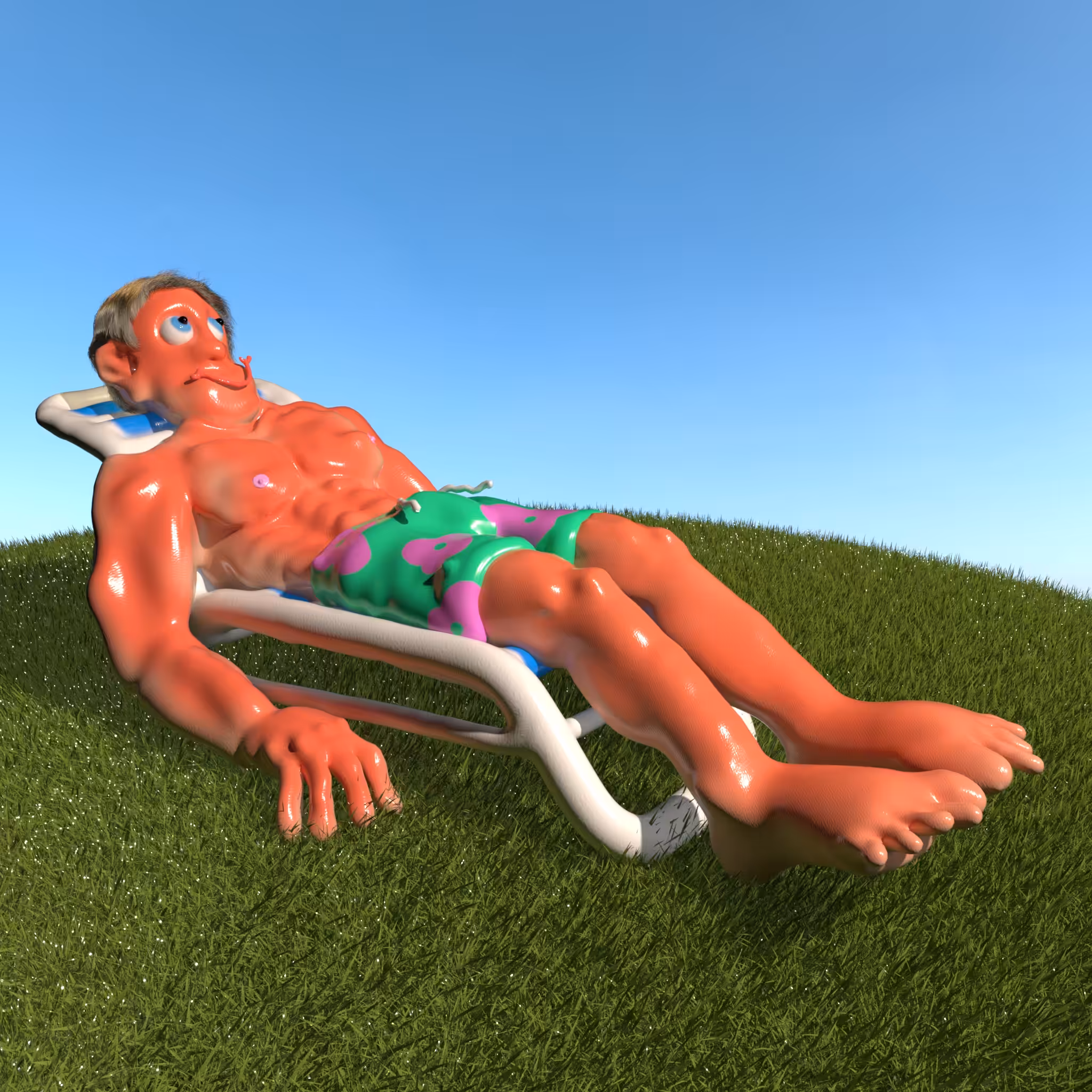 Sunburnt