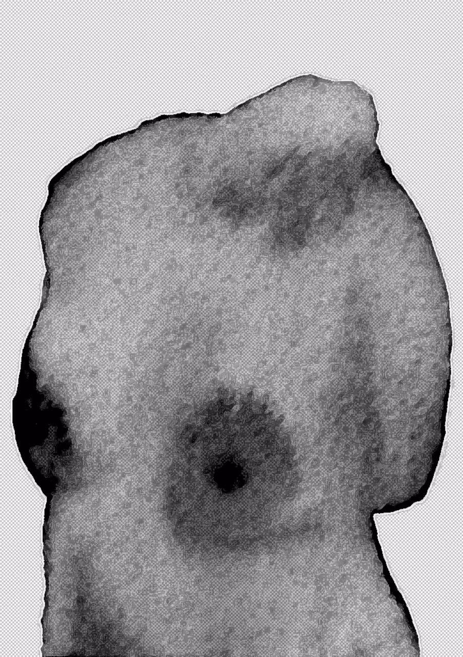 Unnamed