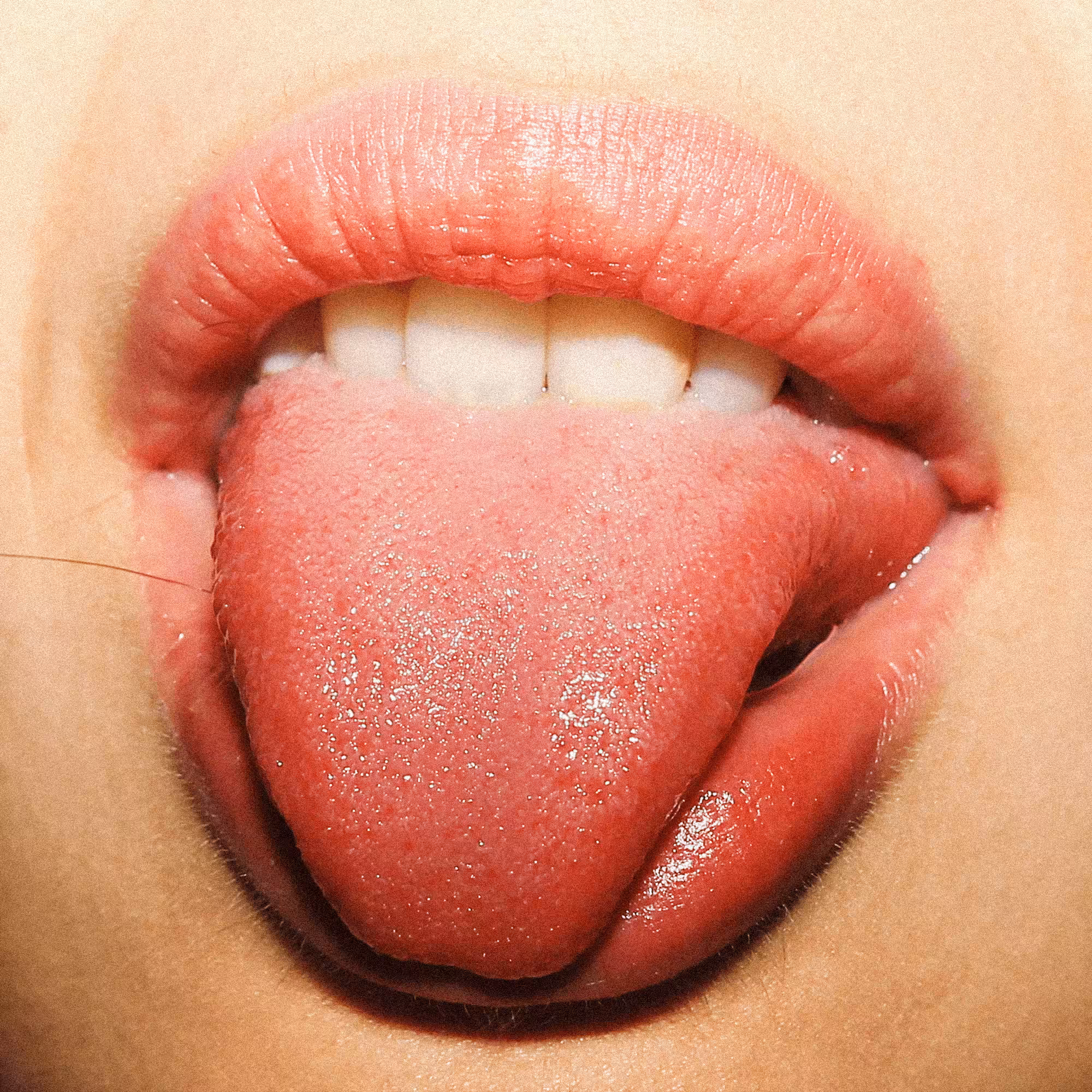 Tongue