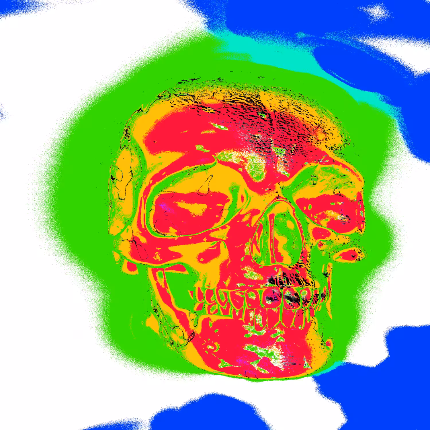 Trashed Skull #5