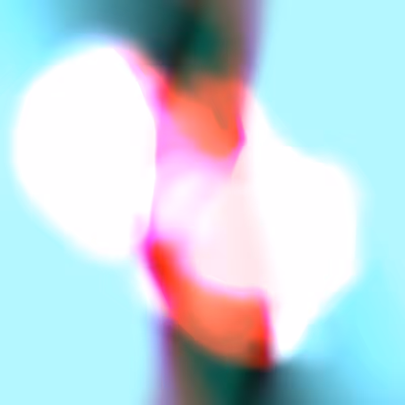 Recuperation - Deterioration #1