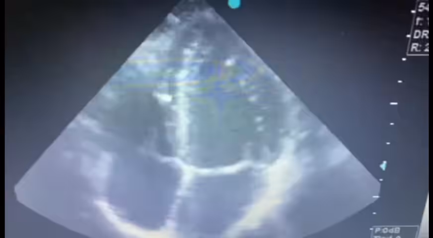 EthereumHeart