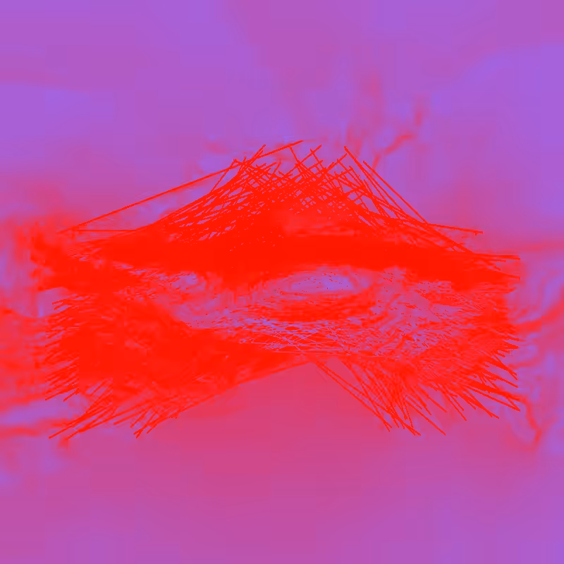 xxf #92