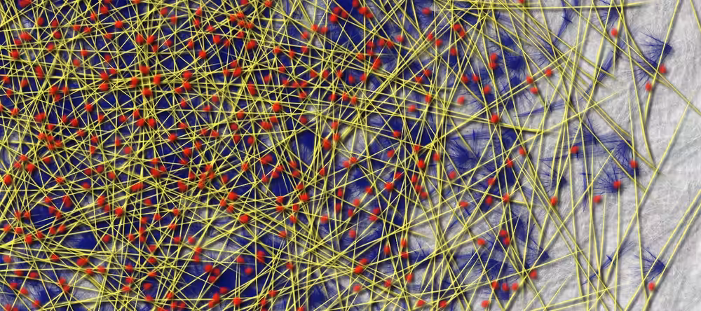 Abstract: Abstact#30