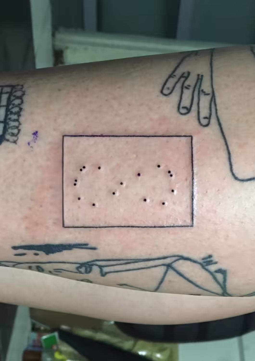 Skin Matrix 