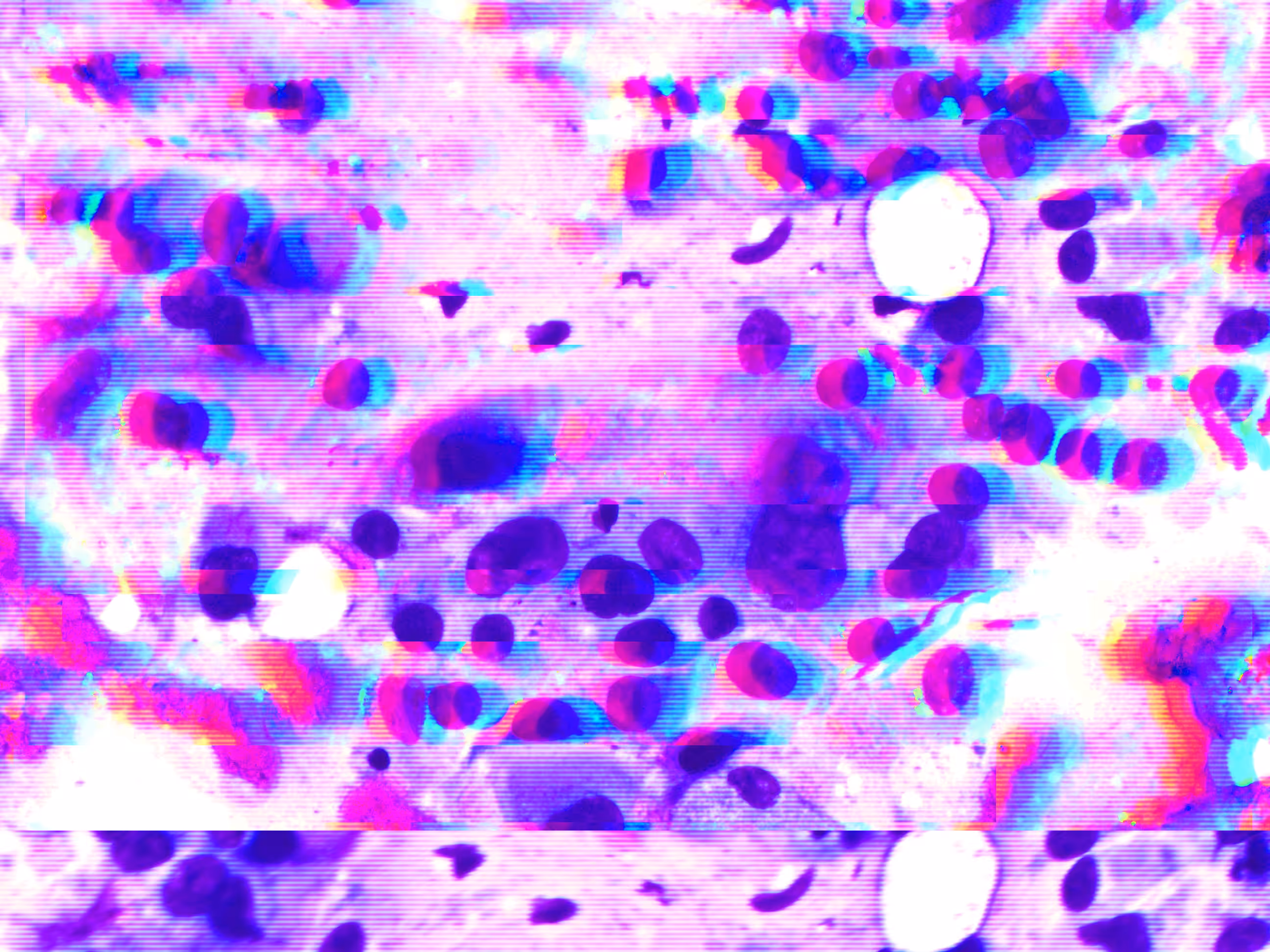 Glitch 2
