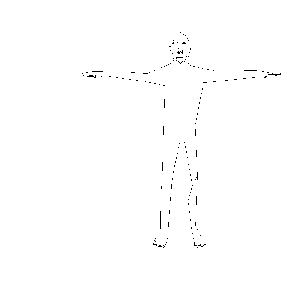 Rig