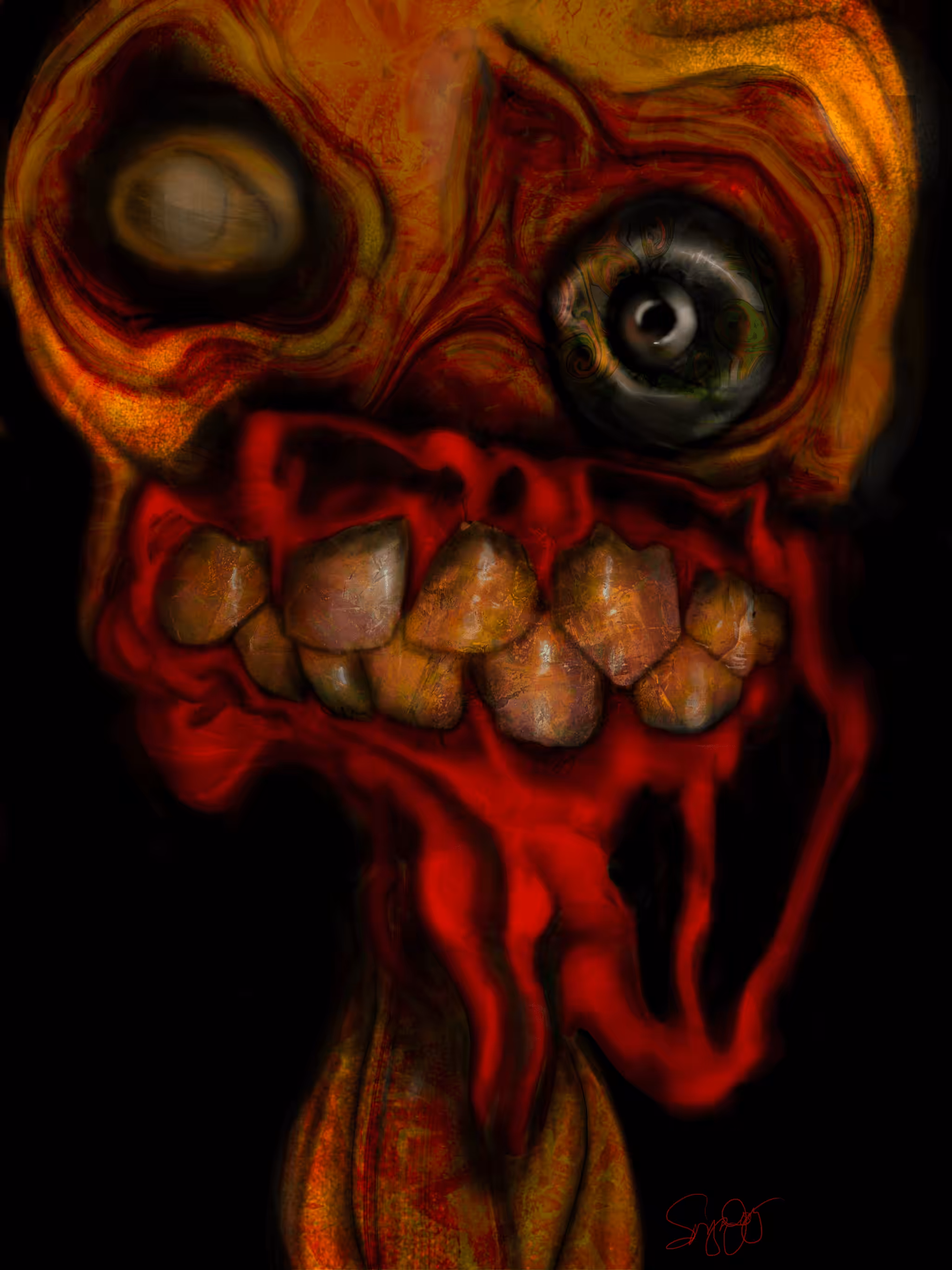 Gum Disease (Gummi for short)
