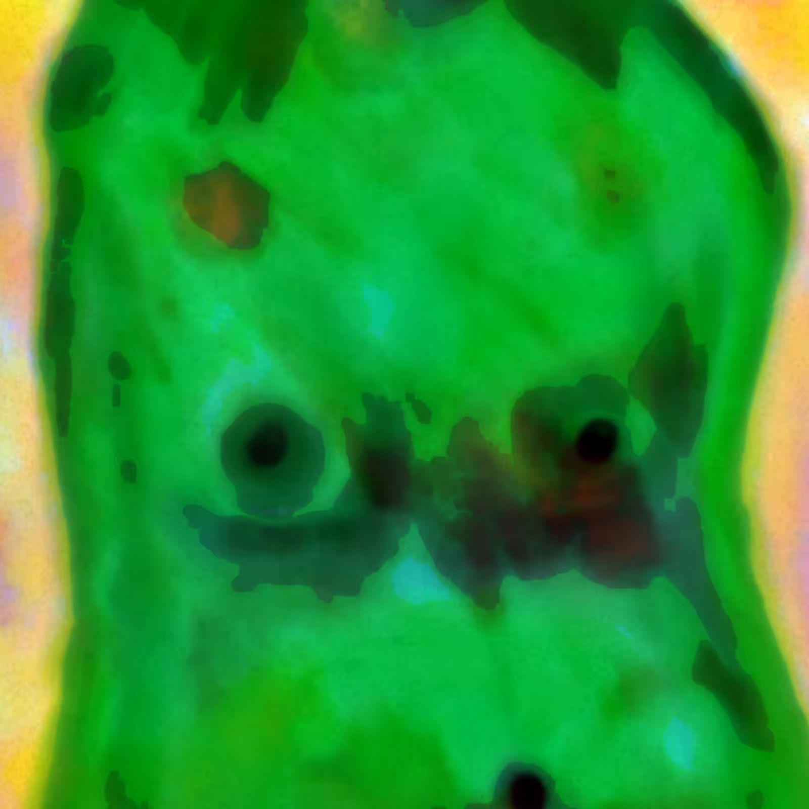 GreenGirl