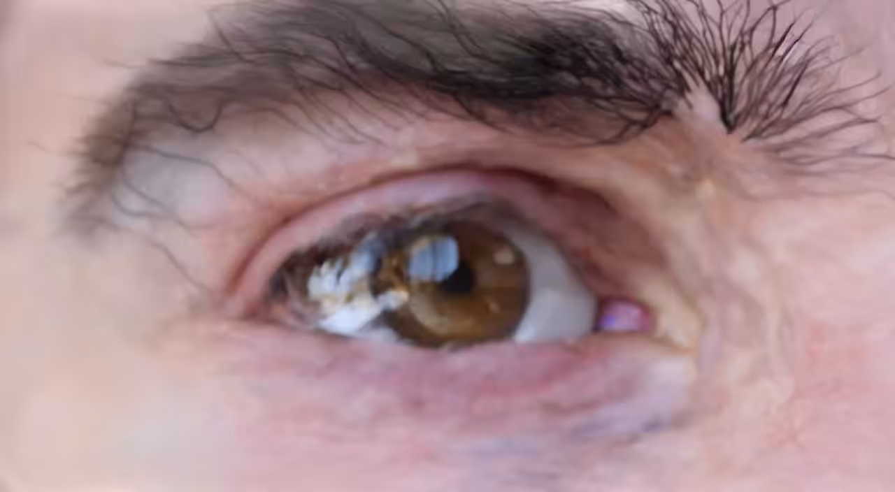 Milo Poelman - Eye 6 - Registering