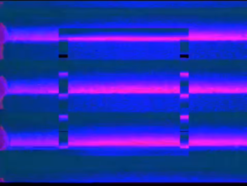 _l i s t e n_