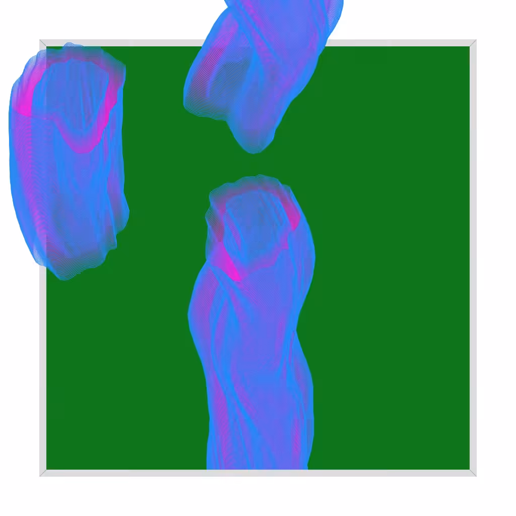 Framed Growth 215