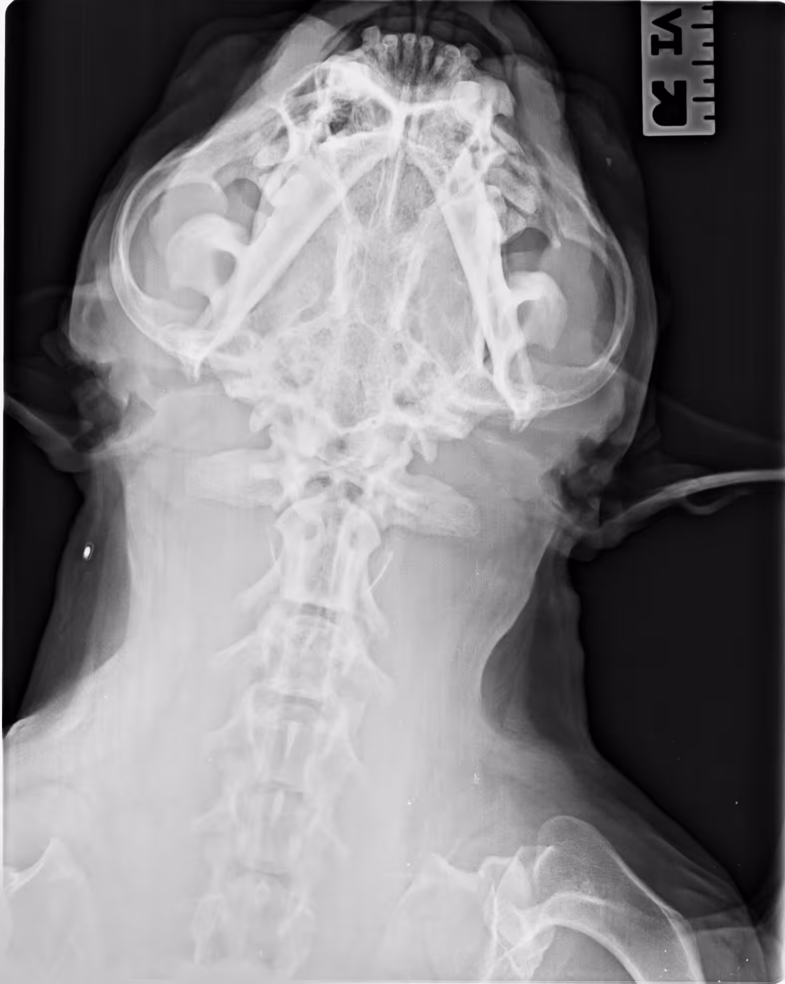 X-ray 04
