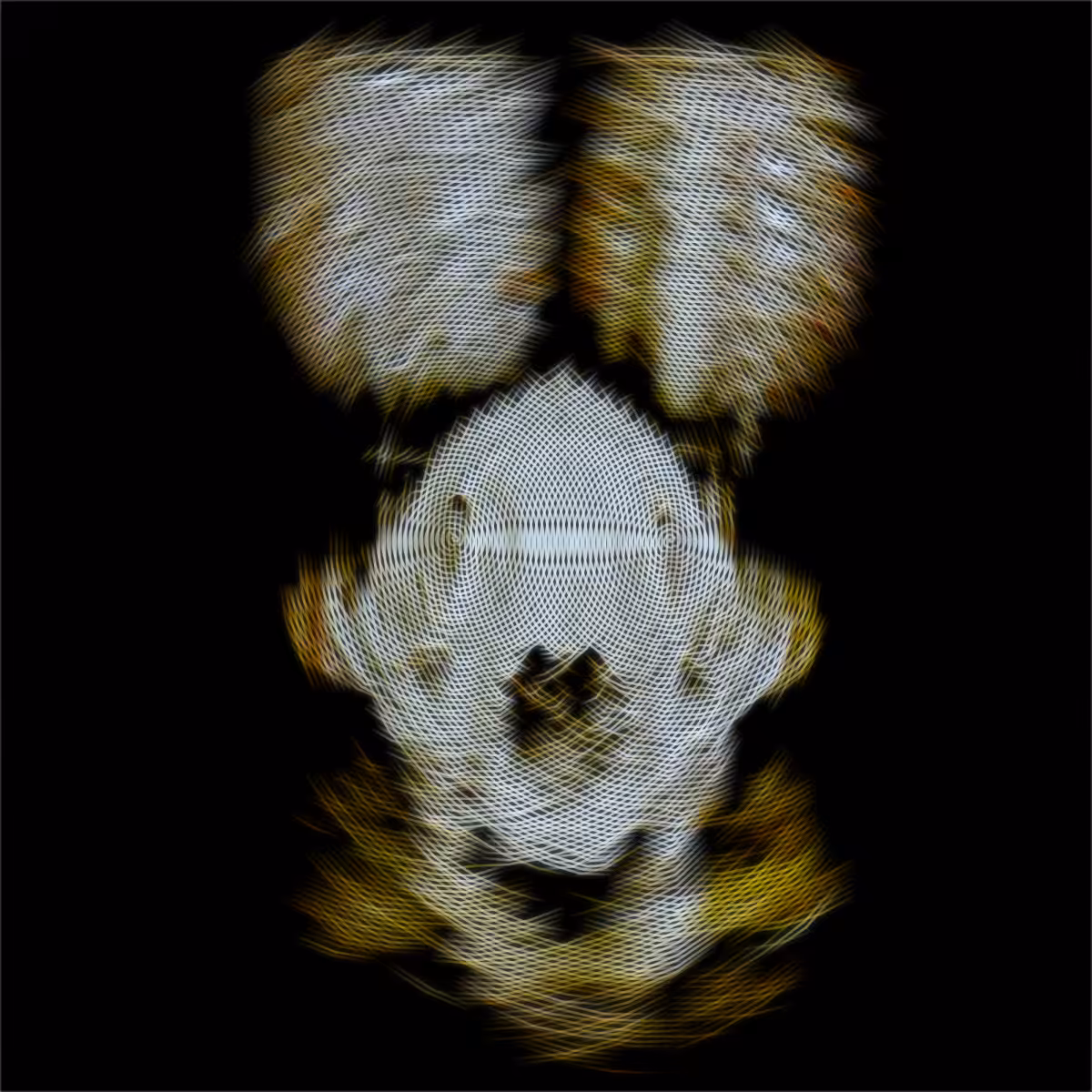SCNLNS-skull