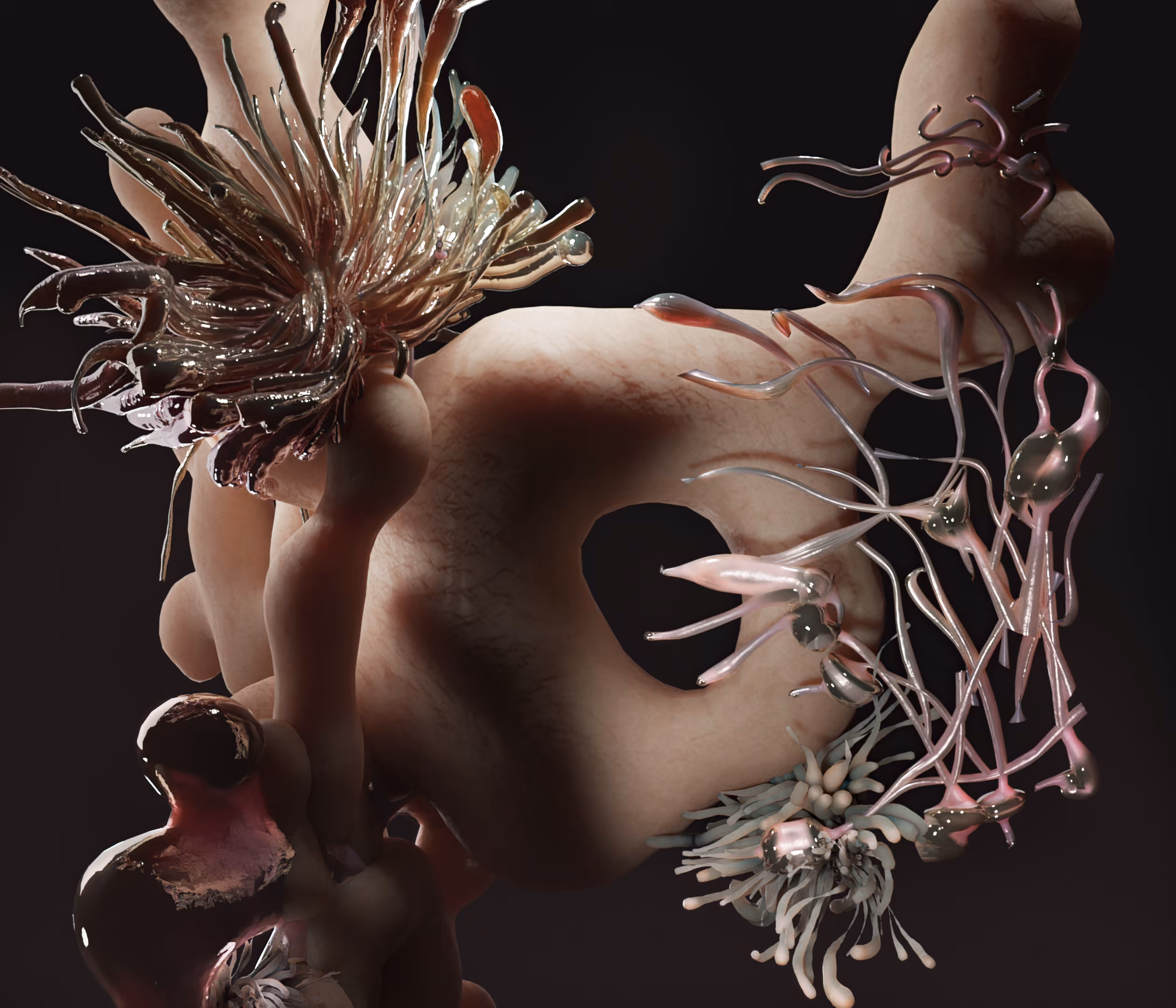 Nonremovable