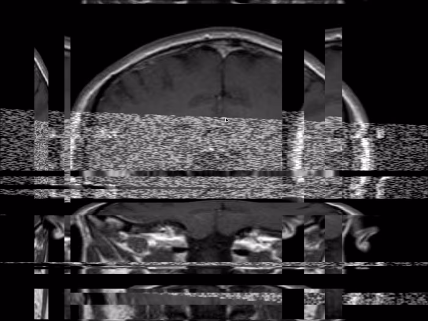 Brain Scan III