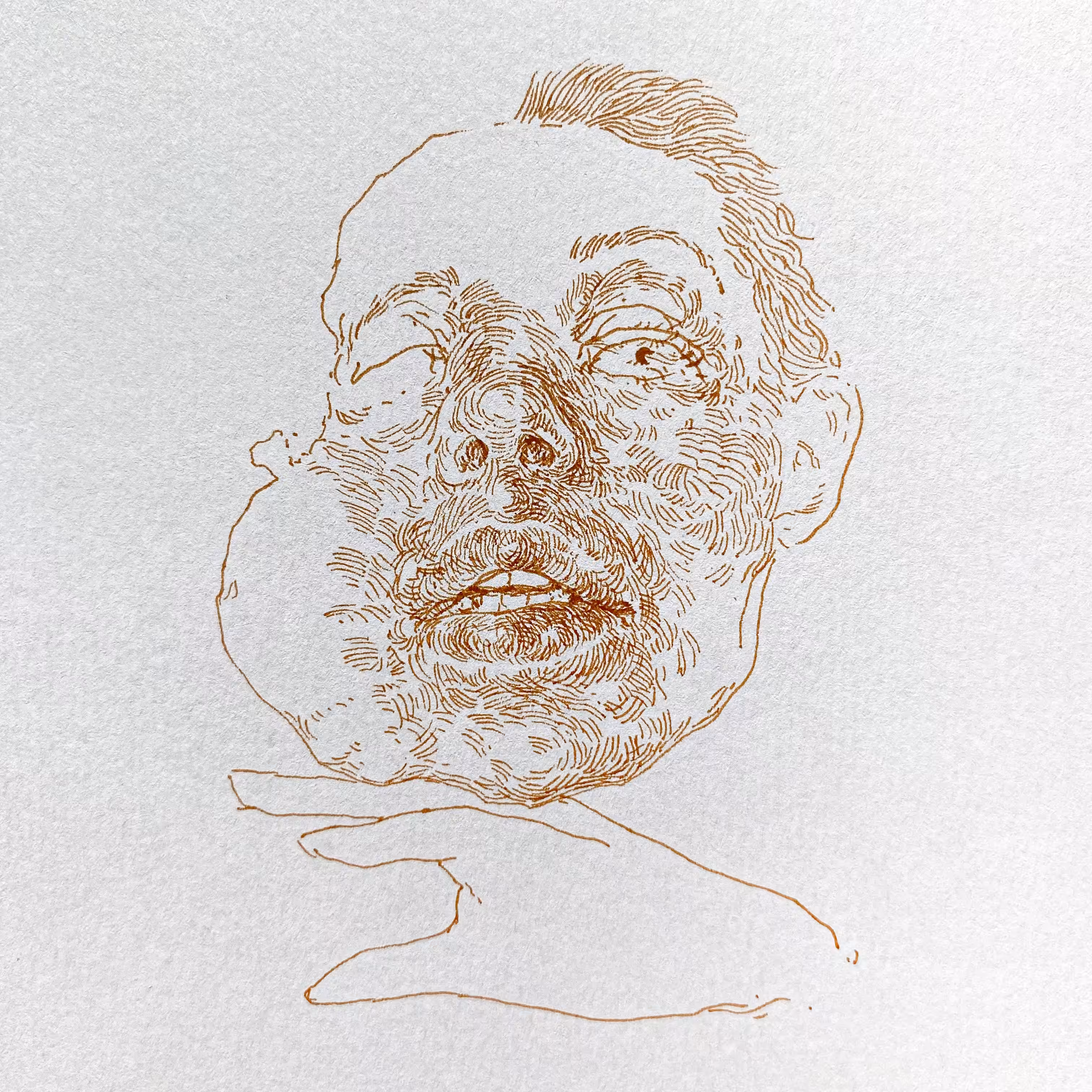 45 (Surprise)