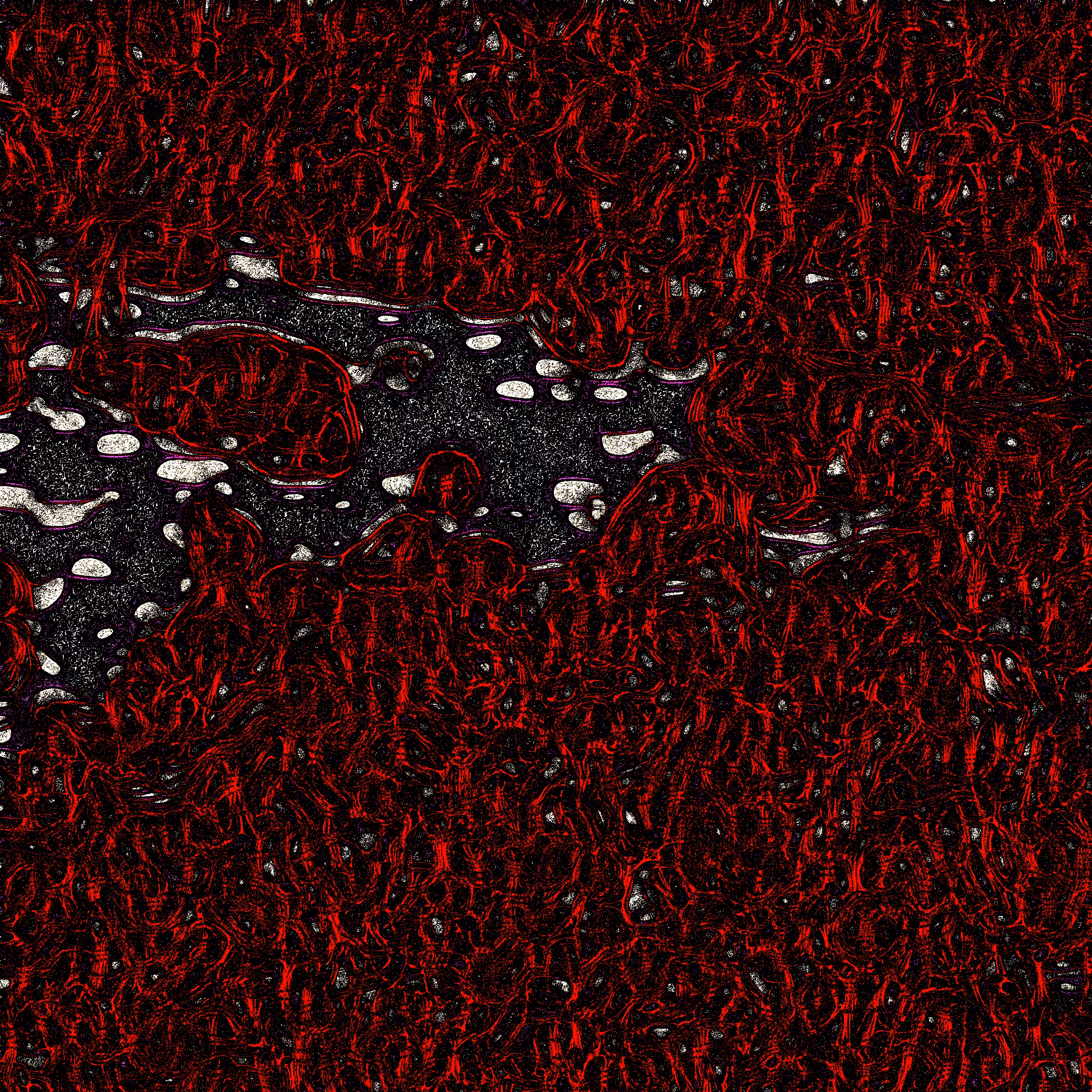 Abstract A1