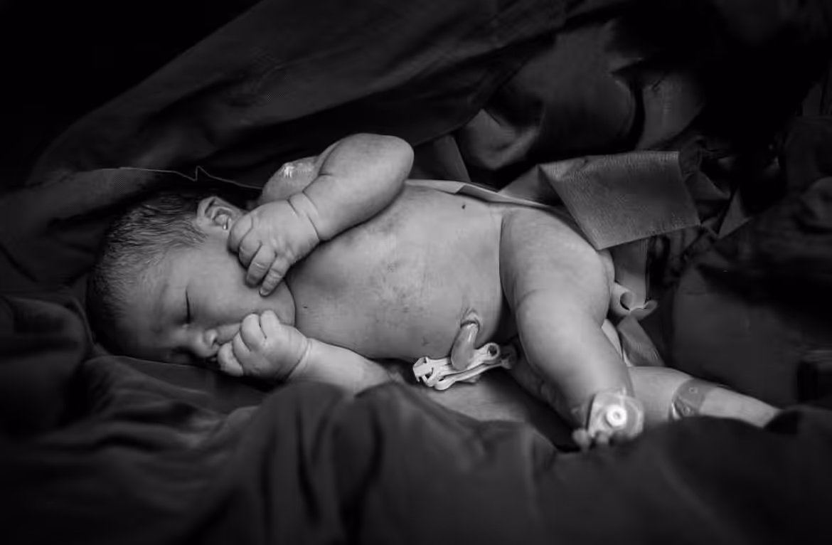 Birth