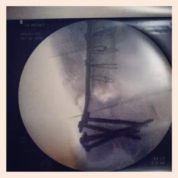 The stuff inside my leg