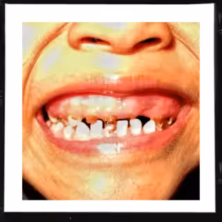 child's smile