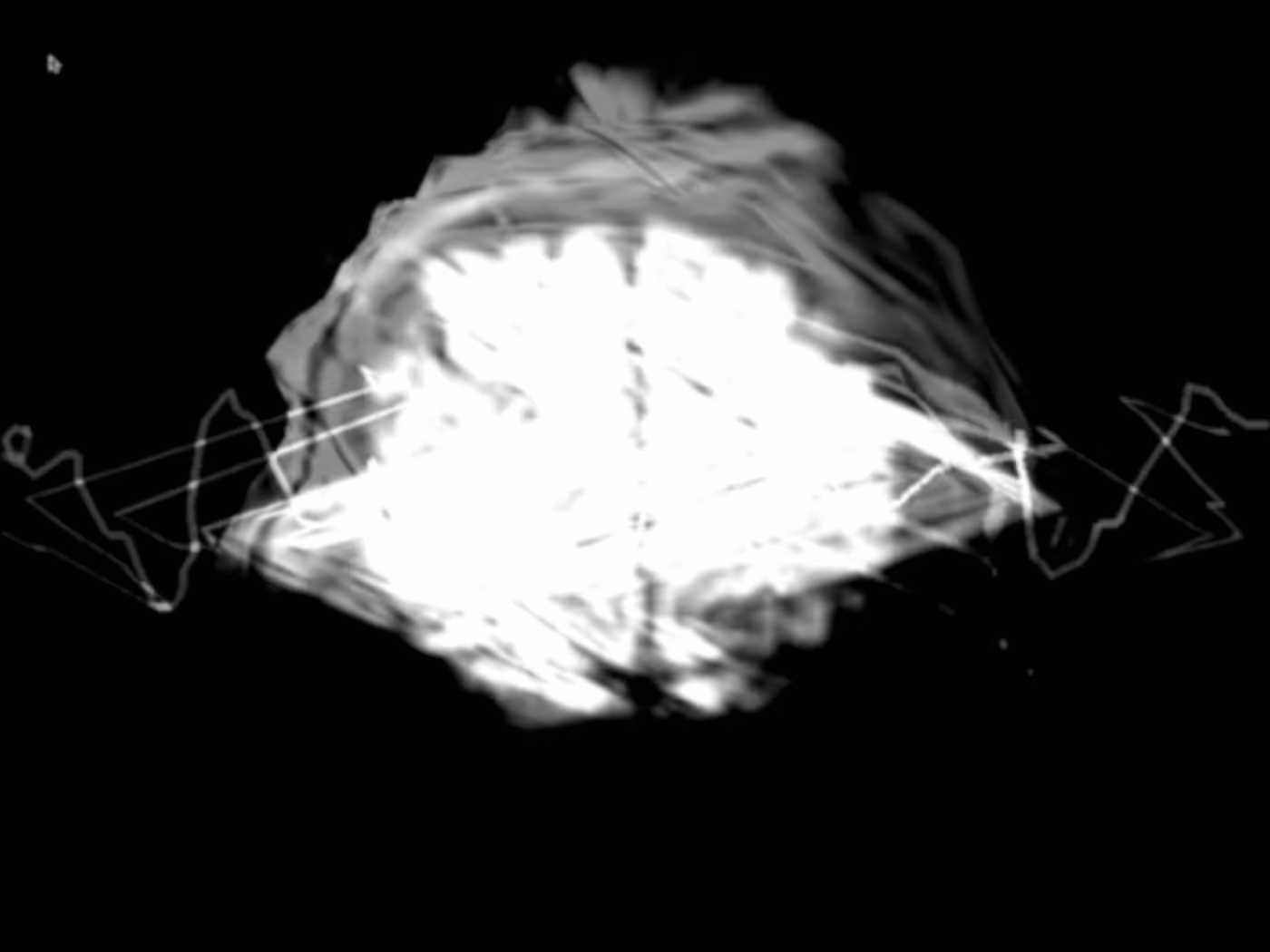 Brain Scan