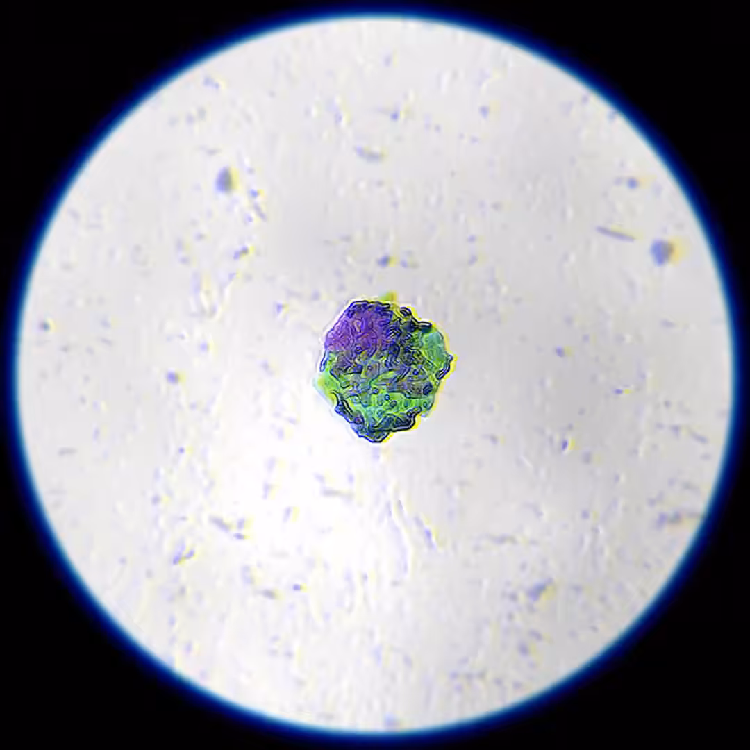 Clusters in Figuro