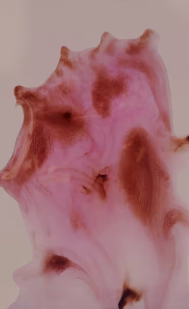 LOVOTIC – III
