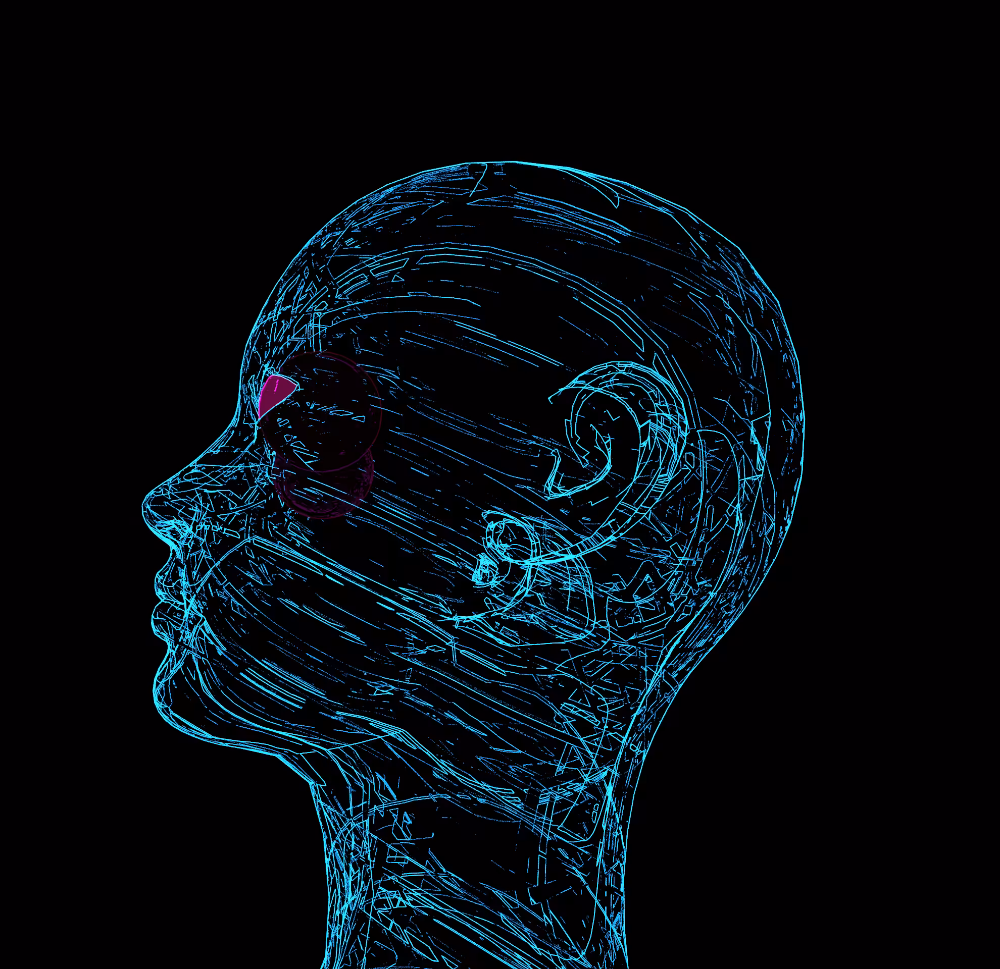 reflux_o #002