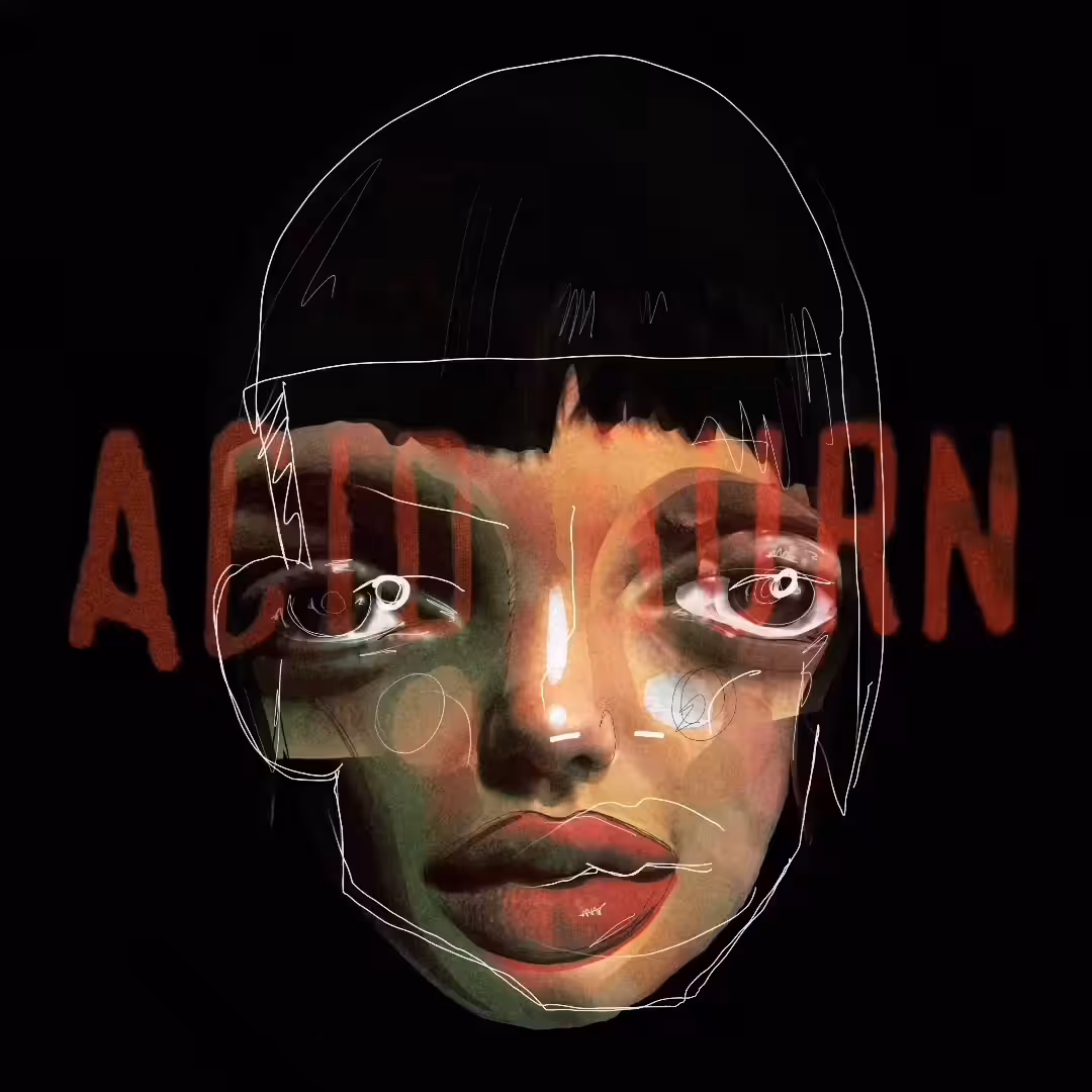 processing_acid_burn