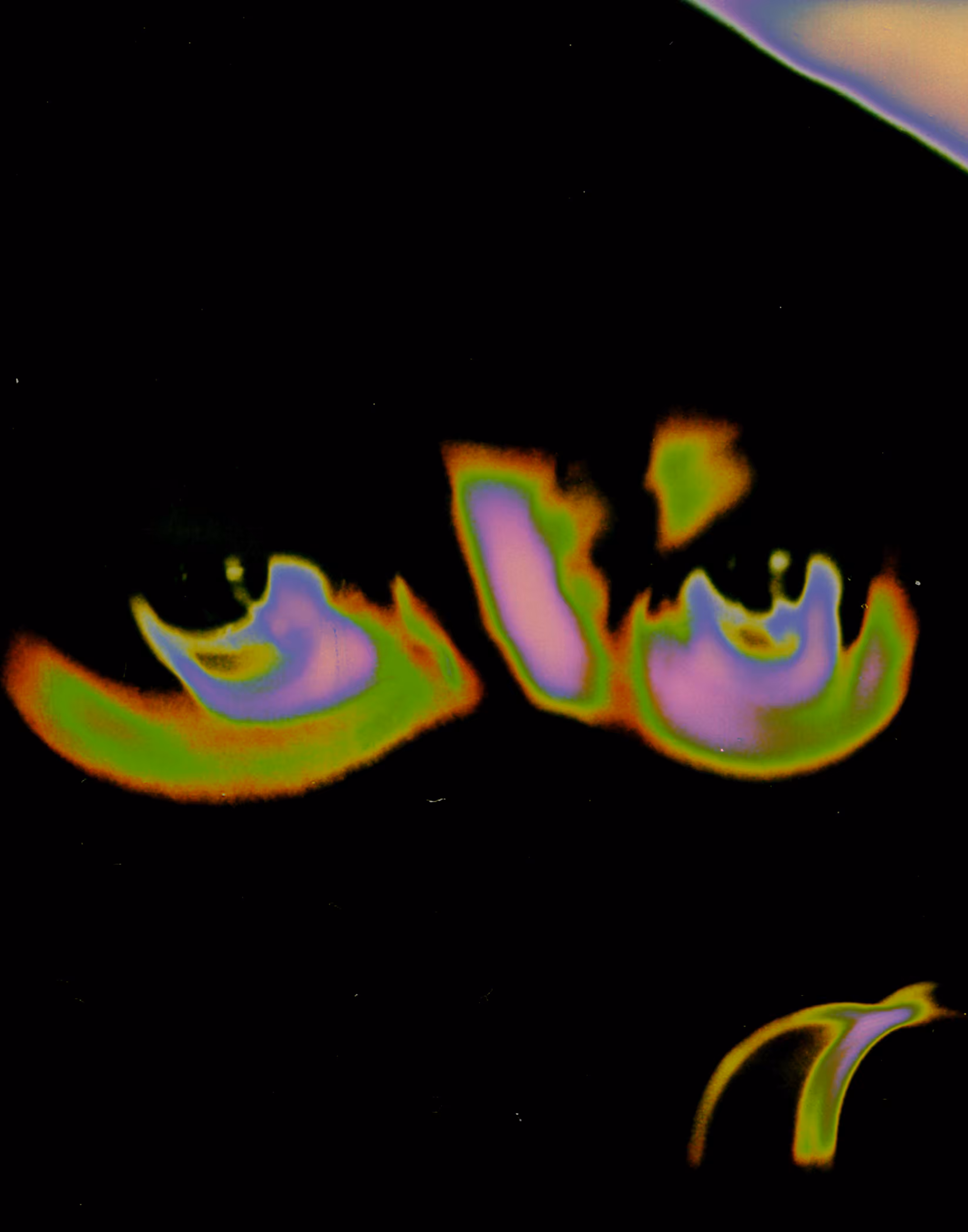 EYE