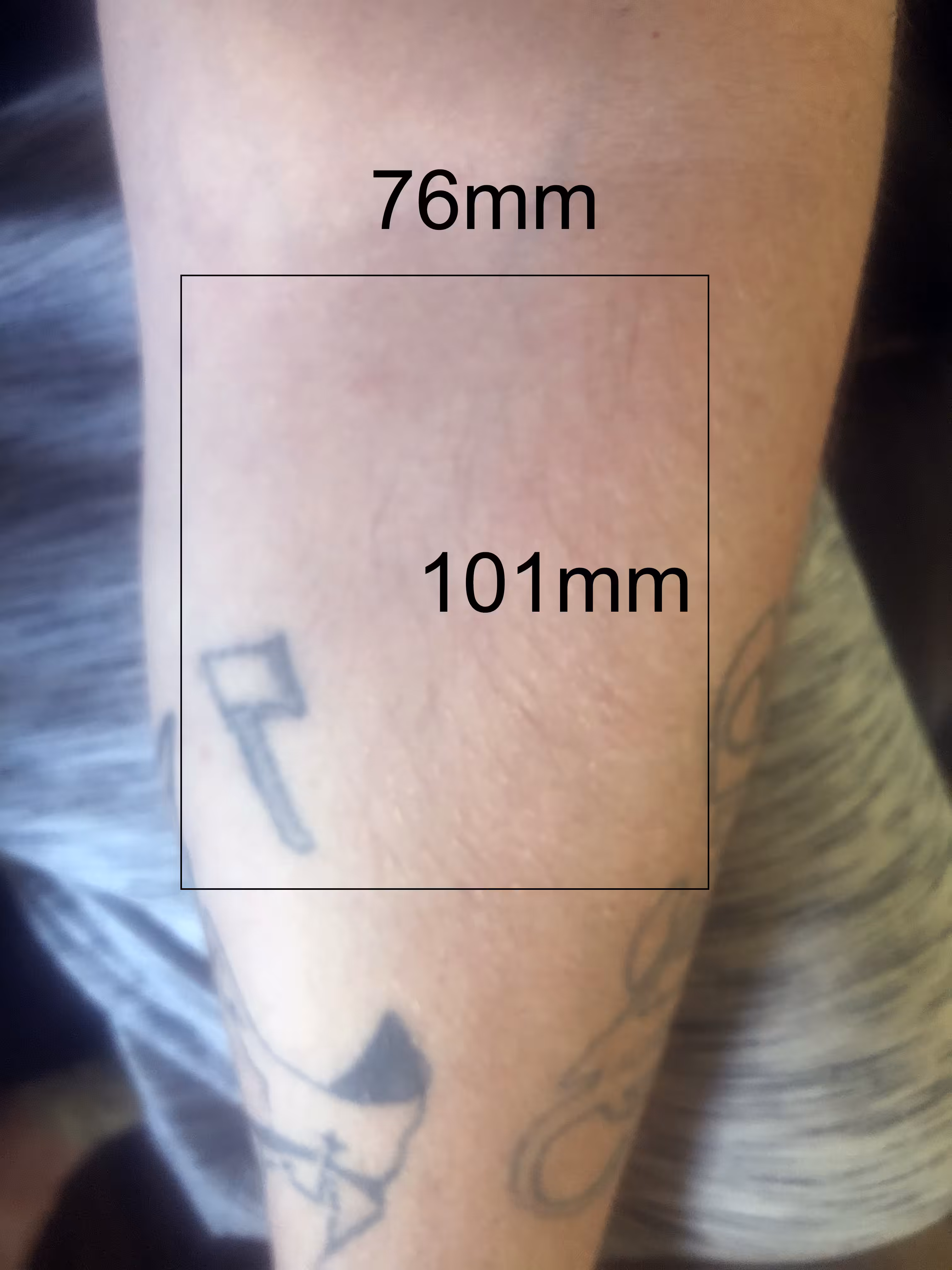Lot #19 [76mm x 101mm Left Inner Arm] (Coverup/Workaround)