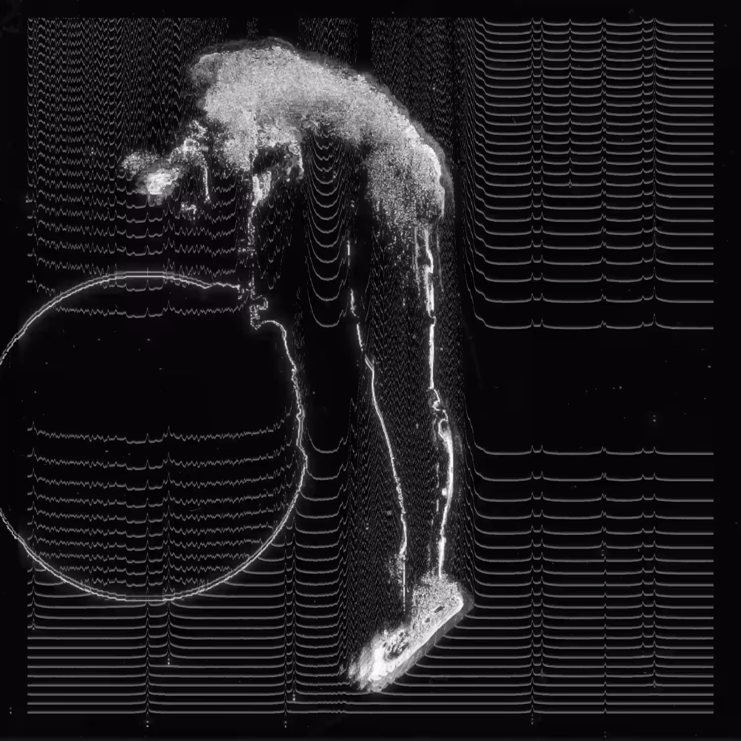 suspended animation