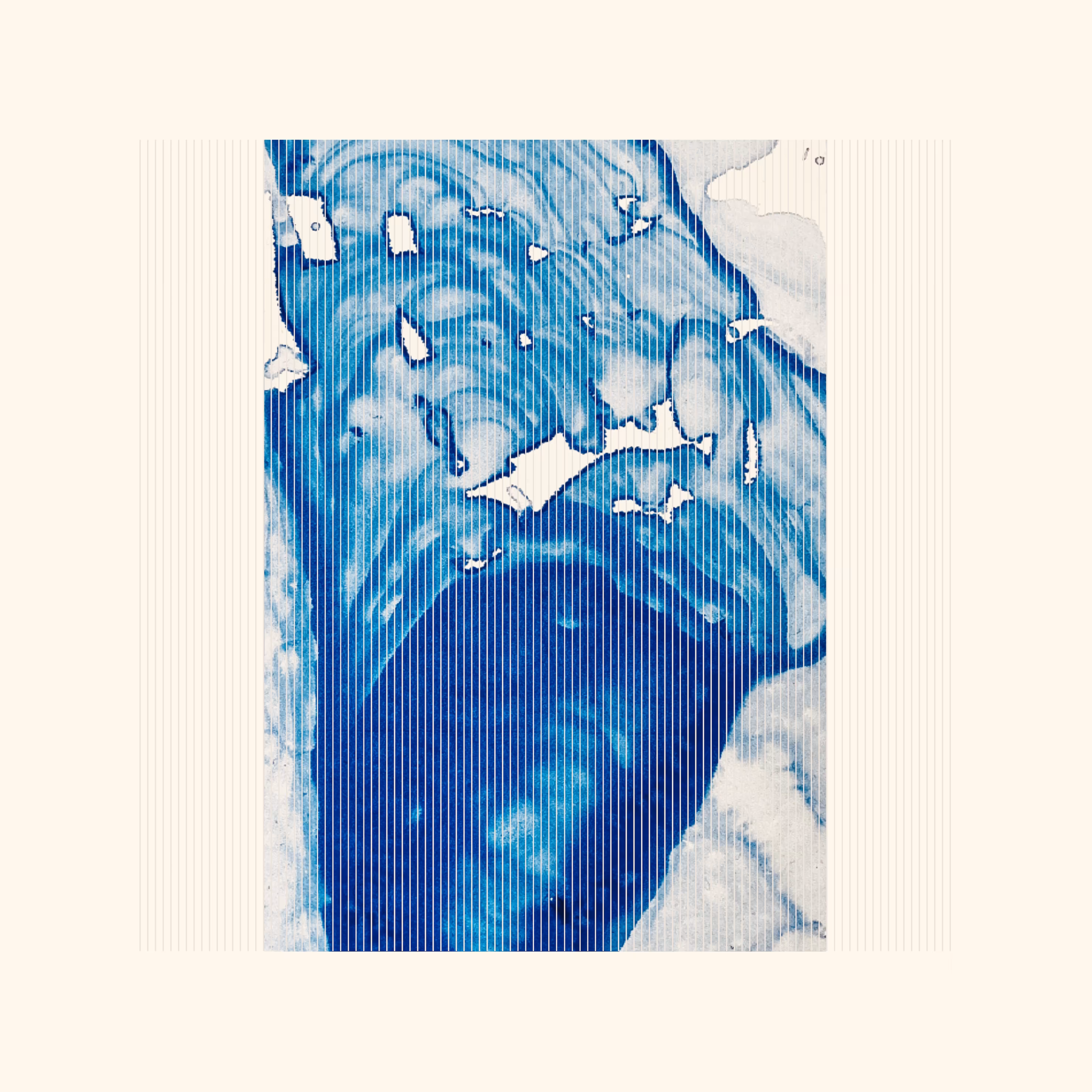 BP 035
