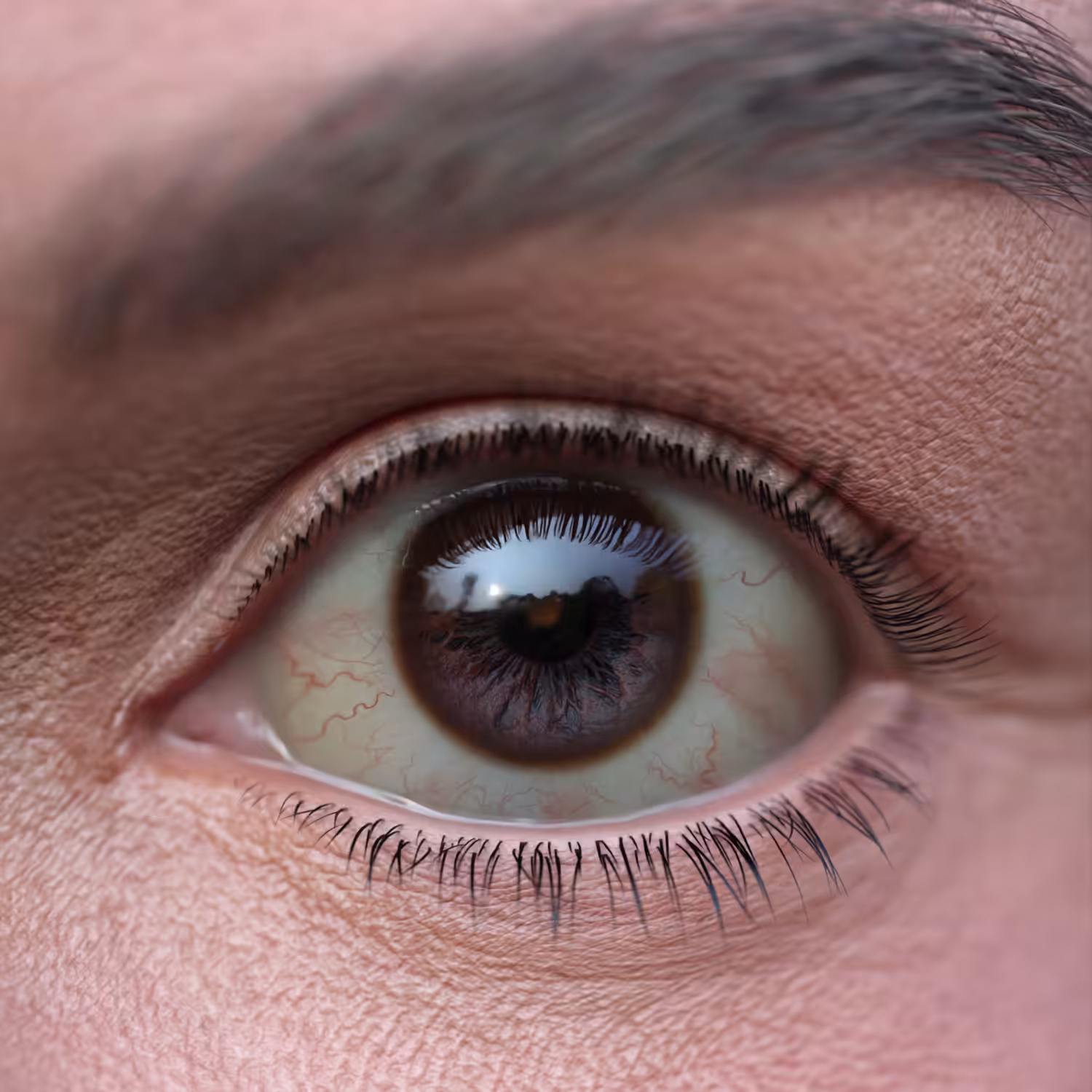 Eye 11